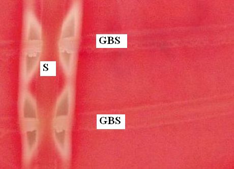 Obr.6: Pozitivní CAMP test na krevním agaru se projevuje jako zesílená hemolýza tvaru motýlích křídel, vertikální čára je laboratorní kmen Staphylococcus aureus (S), horizontální čáry jsou testovaný kmen Streptococcus agalactiae (GBS), zvětšeno 3x 