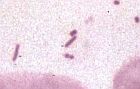MOP I - II, epitele, laktobacily, ojediněle grampozitivní koky (S.agalactiae), zvětšeno 1500x