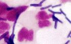 MOP I - III, převaha leukocytů, laktobacily, izolován S.agalactiae, zvětšeno 1500x 
