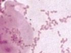 MOP IIa, převaha epitelií, klíčové buňky, smíšená mikroflóra bakteriální vaginózy bez mobilunků, zvětšeno 1500x
