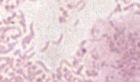 MOP IIb, převaha epitelií, klíčové buňky, smíšená mikroflóra bakteriální vaginózy + zakřivené tyčky rodu Mobiluncus, zvětšeno 1500x