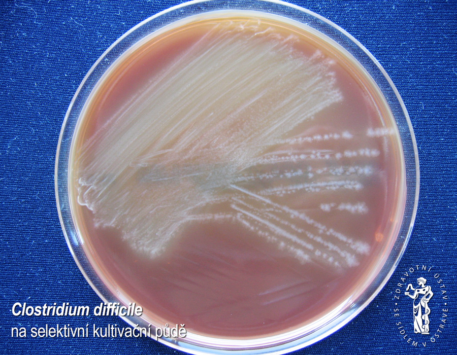 Clostridium difficile na selektivní kultivační půdě