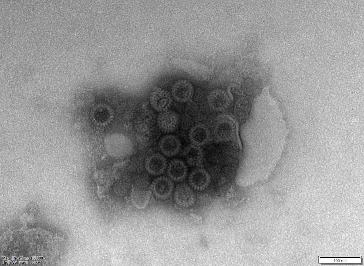 rotaviry ve 150.000× zvětšení